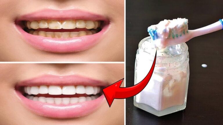 Cette ancienne méthode naturelle peut raviver l’éclat de vos dents…